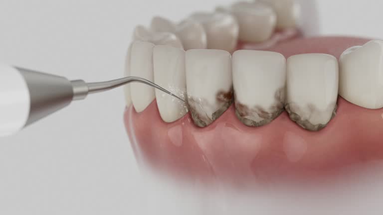 Trusted Root Canal Treatment service in Rushville, IL - Dentist Open Now